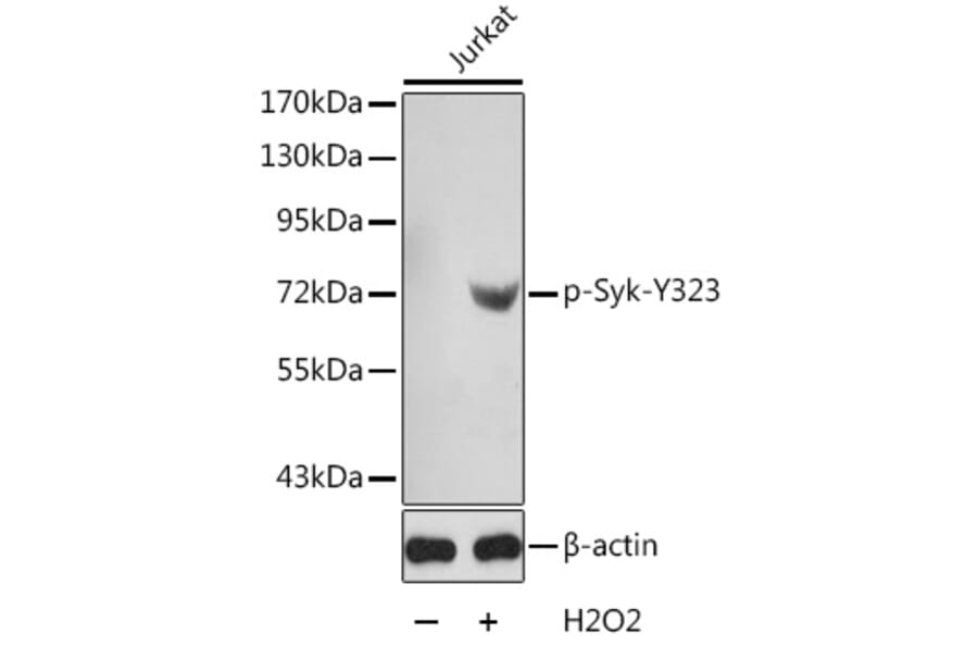 Western Blot - Anti-Syk (phospho Tyr323) Antibody (A10913) - Antibodies.com
