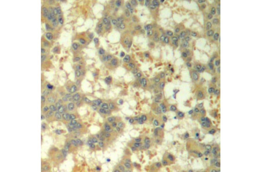 Immunohistochemistry - Anti-Syk (phospho Tyr323) Antibody (A10913) - Antibodies.com