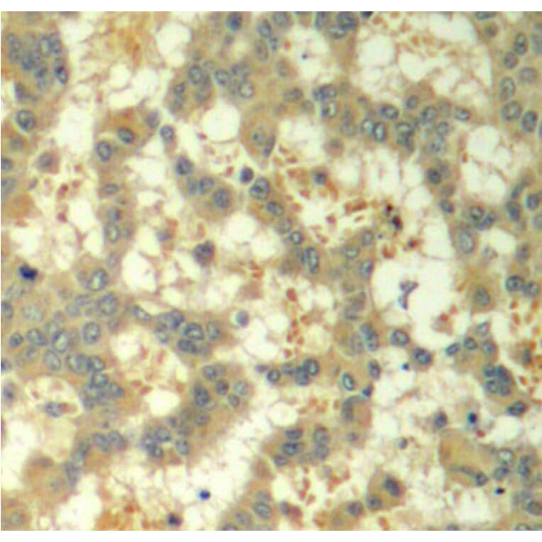 Immunohistochemistry - Anti-Syk (phospho Tyr323) Antibody (A10913) - Antibodies.com