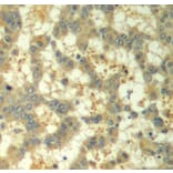 Immunohistochemistry - Anti-Syk (phospho Tyr323) Antibody (A10913) - Antibodies.com