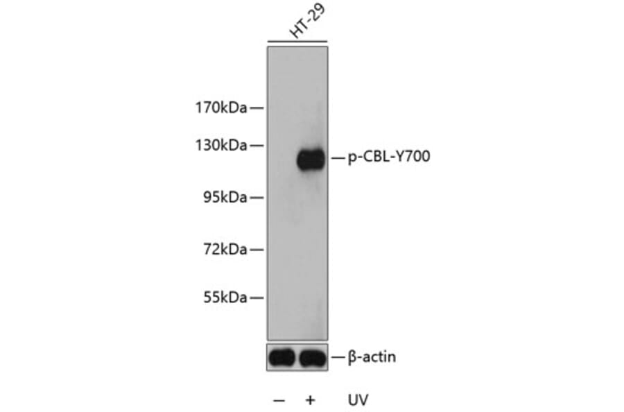 Western Blot - Anti-CBL (phospho Y700) Antibody (AP0292) - Antibodies.com