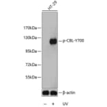 Western Blot - Anti-CBL (phospho Y700) Antibody (AP0292) - Antibodies.com