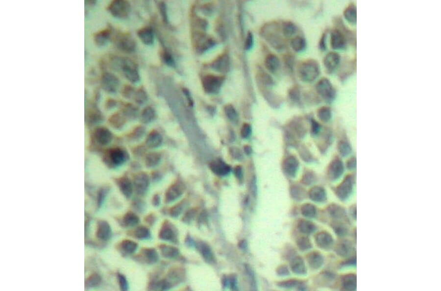 Immunohistochemistry - Anti-CBL (phospho Y700) Antibody (AP0292) - Antibodies.com