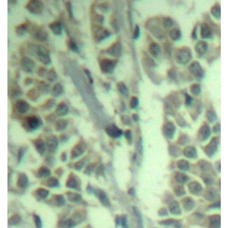 Immunohistochemistry - Anti-CBL (phospho Y700) Antibody (AP0292) - Antibodies.com