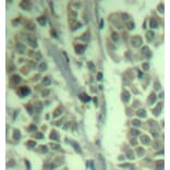 Immunohistochemistry - Anti-CBL (phospho Y700) Antibody (AP0292) - Antibodies.com