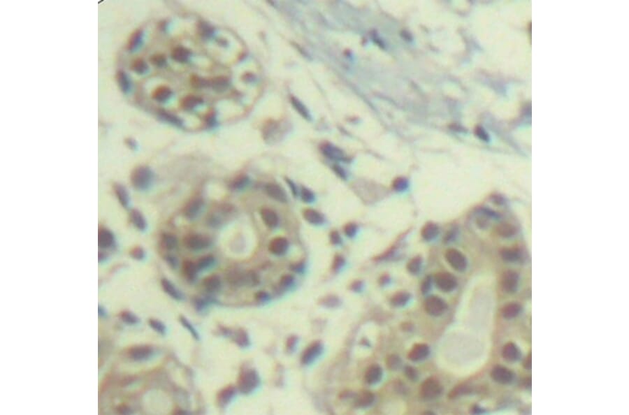 Immunohistochemistry - Anti-MDM2 (phospho S166) Antibody (AP0293) - Antibodies.com
