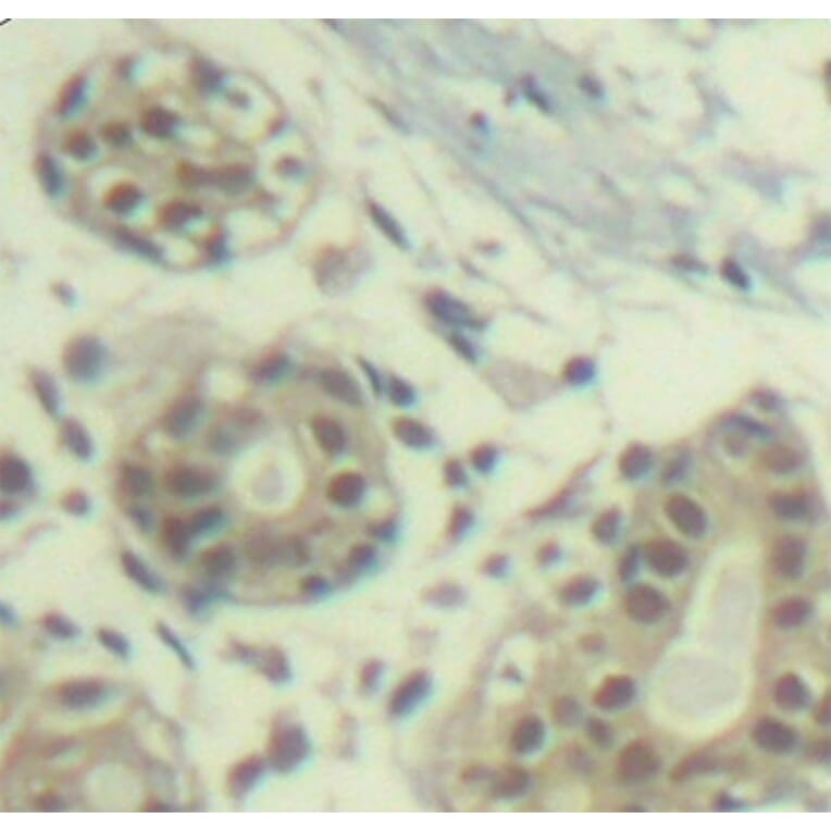 Immunohistochemistry - Anti-MDM2 (phospho S166) Antibody (AP0293) - Antibodies.com