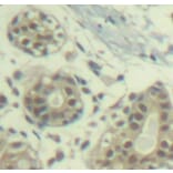 Immunohistochemistry - Anti-MDM2 (phospho S166) Antibody (AP0293) - Antibodies.com