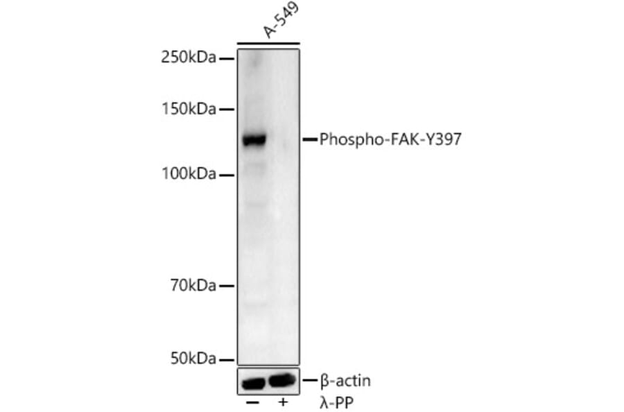 Western Blot - Anti-FAK (phospho Tyr397) Antibody (A10917) - Antibodies.com