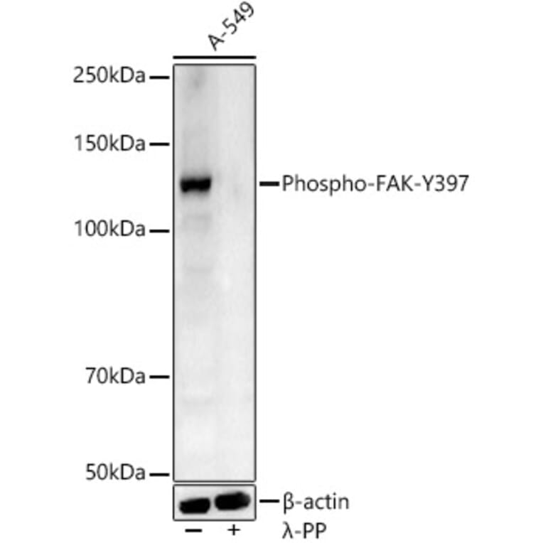 Western Blot - Anti-FAK (phospho Tyr397) Antibody (A10917) - Antibodies.com