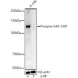 Western Blot - Anti-FAK (phospho Tyr397) Antibody (A10917) - Antibodies.com
