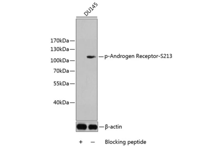 Western Blot - Anti-Androgen Receptor (phospho Ser213) Antibody (A10918) - Antibodies.com