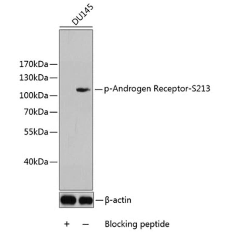 Western Blot - Anti-Androgen Receptor (phospho Ser213) Antibody (A10918) - Antibodies.com