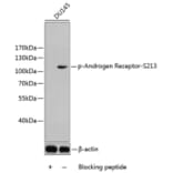 Western Blot - Anti-Androgen Receptor (phospho Ser213) Antibody (A10918) - Antibodies.com
