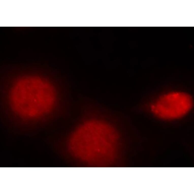 Immunofluorescence - Anti-Androgen Receptor (phospho Ser213) Antibody (A10918) - Antibodies.com