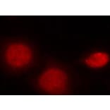 Immunofluorescence - Anti-Androgen Receptor (phospho Ser213) Antibody (A10918) - Antibodies.com