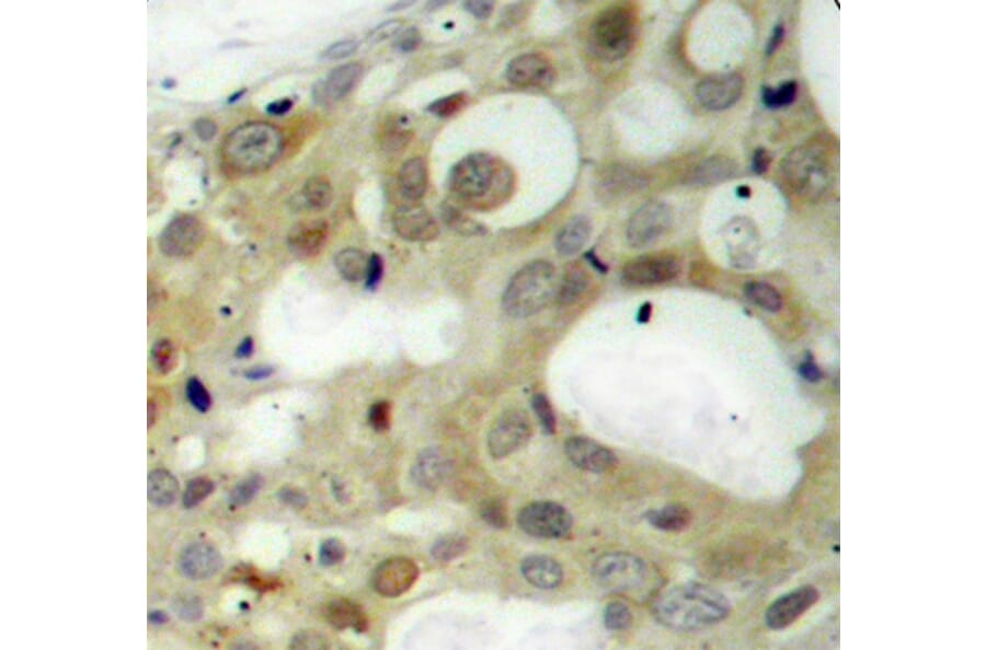 Immunohistochemistry - Anti-Androgen Receptor (phospho Ser650) Antibody (A10919) - Antibodies.com
