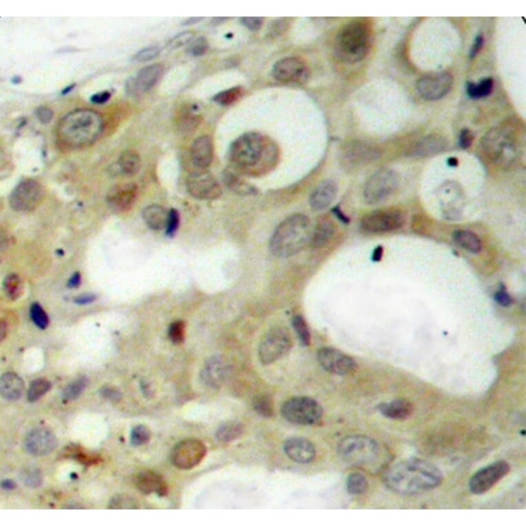 Immunohistochemistry - Anti-Androgen Receptor (phospho Ser650) Antibody (A10919) - Antibodies.com