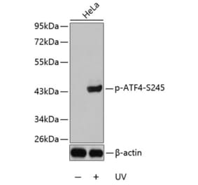 Western Blot - Anti-ATF-4 (phospho Ser245) Antibody (A10920) - Antibodies.com