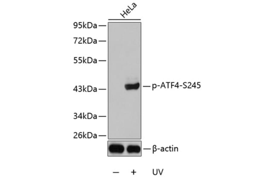 Western Blot - Anti-ATF-4 (phospho Ser245) Antibody (A10920) - Antibodies.com