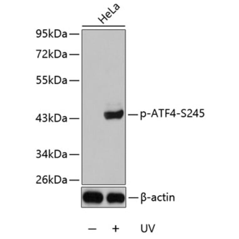 Western Blot - Anti-ATF-4 (phospho Ser245) Antibody (A10920) - Antibodies.com