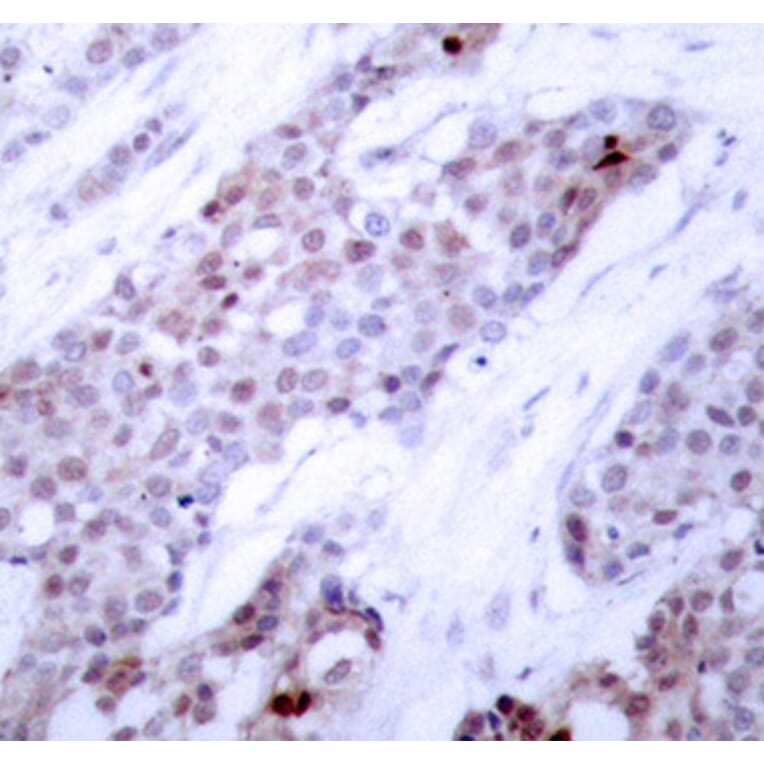 Immunohistochemistry - Anti-ATF-4 (phospho Ser245) Antibody (A10920) - Antibodies.com