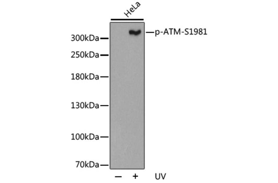Western Blot - Anti-ATM (phospho S1981) Antibody (AP0310) - Antibodies.com