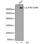 Western Blot - Anti-ATM (phospho S1981) Antibody (AP0310) - Antibodies.com
