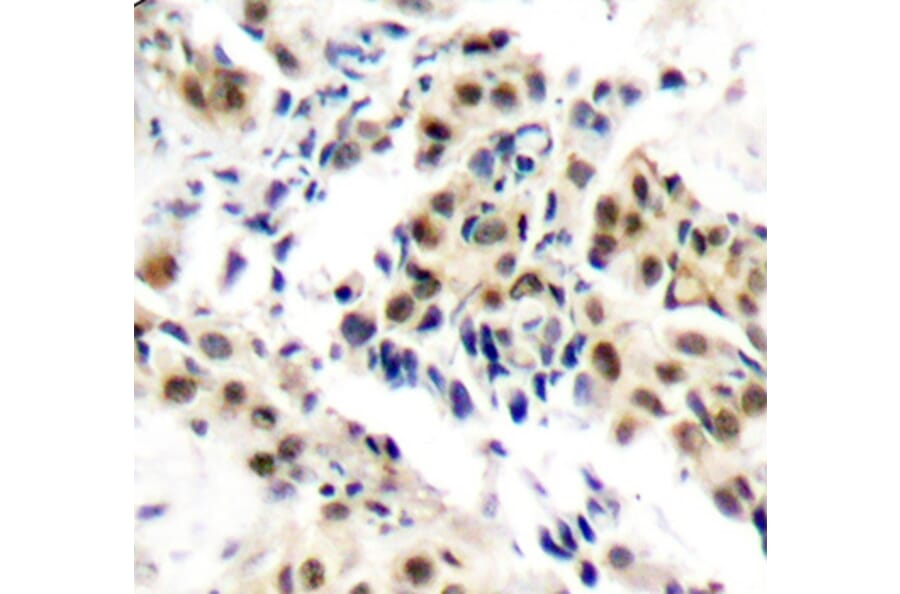 Immunohistochemistry - Anti-ATM (phospho S1981) Antibody (AP0310) - Antibodies.com