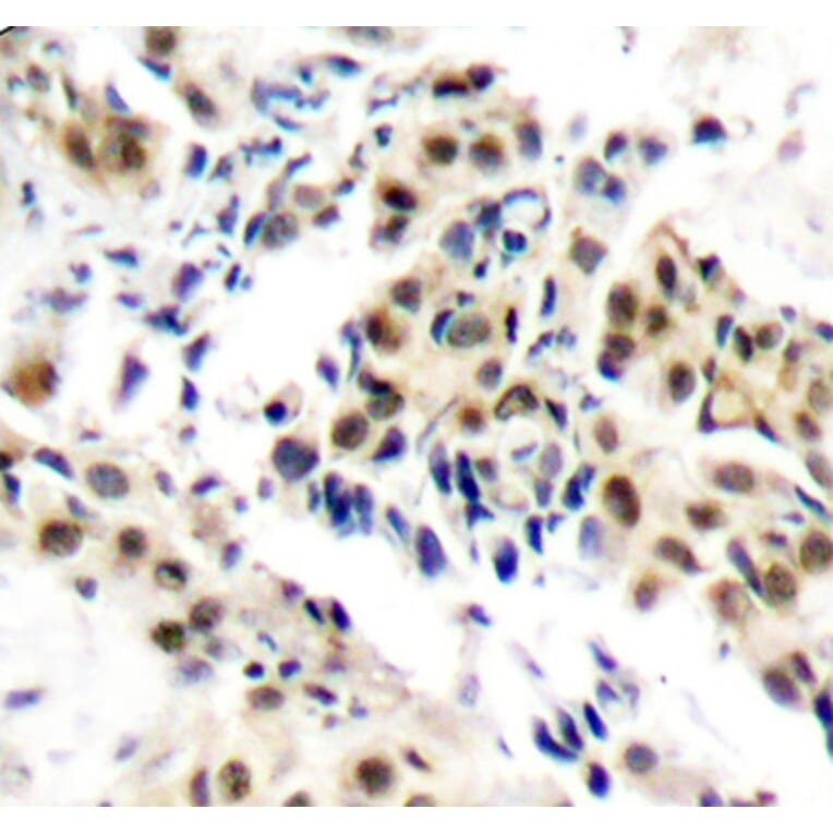 Immunohistochemistry - Anti-ATM (phospho S1981) Antibody (AP0310) - Antibodies.com