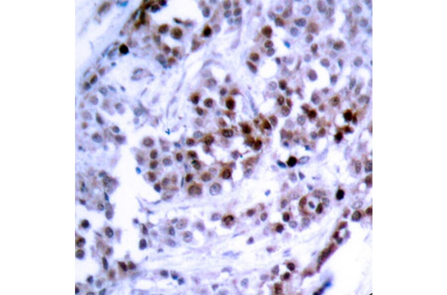 Immunohistochemistry - Anti-BCL2 (phospho S70) Antibody (AP0315) - Antibodies.com