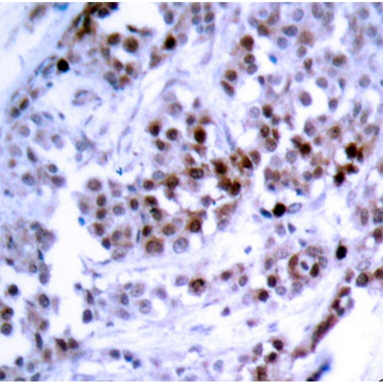 Immunohistochemistry - Anti-BCL2 (phospho S70) Antibody (AP0315) - Antibodies.com