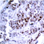 Immunohistochemistry - Anti-BCL2 (phospho S70) Antibody (AP0315) - Antibodies.com