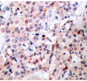 Immunohistochemistry - Anti-Bcl-2 (phospho Thr56) Antibody (A10923) - Antibodies.com