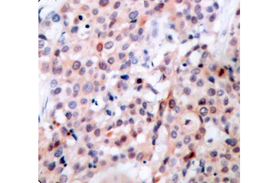 Immunohistochemistry - Anti-Bcl-2 (phospho Thr56) Antibody (A10923) - Antibodies.com
