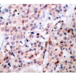 Immunohistochemistry - Anti-Bcl-2 (phospho Thr56) Antibody (A10923) - Antibodies.com