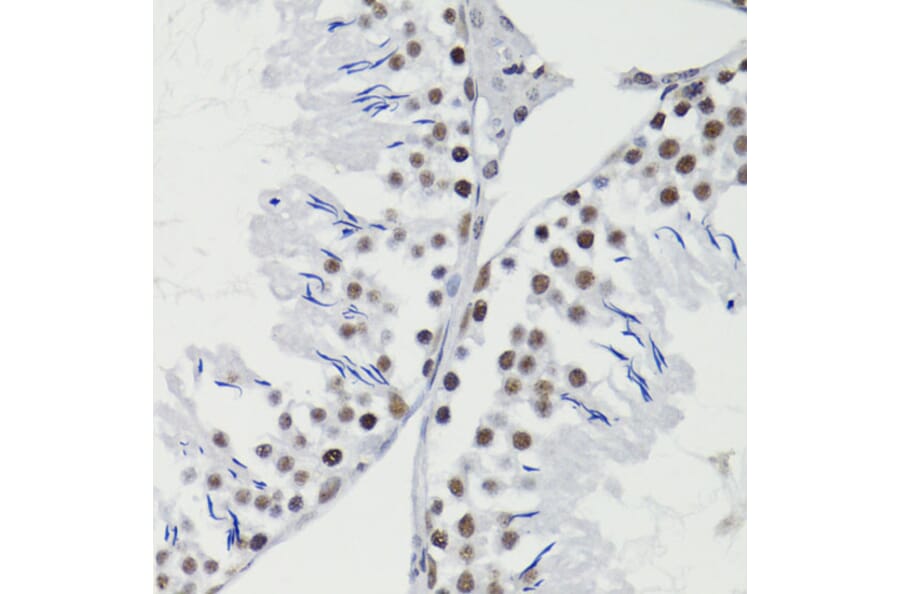 Immunohistochemistry - Anti-Bcl-2 (phospho Thr56) Antibody (A10923) - Antibodies.com