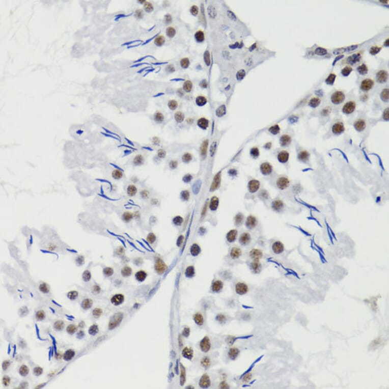 Immunohistochemistry - Anti-Bcl-2 (phospho Thr56) Antibody (A10923) - Antibodies.com