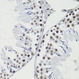 Immunohistochemistry - Anti-Bcl-2 (phospho Thr56) Antibody (A10923) - Antibodies.com