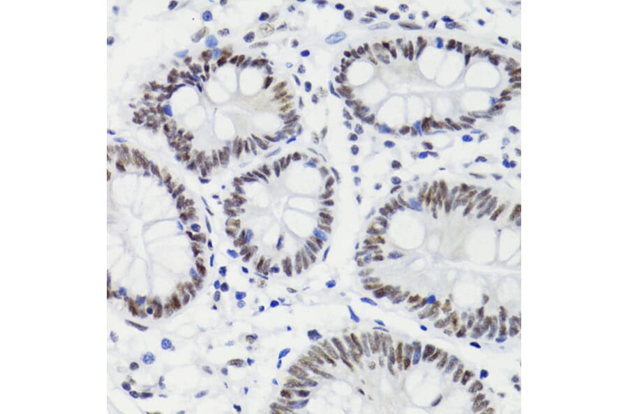Immunohistochemistry - Anti-Bcl-2 (phospho Thr56) Antibody (A10923) - Antibodies.com