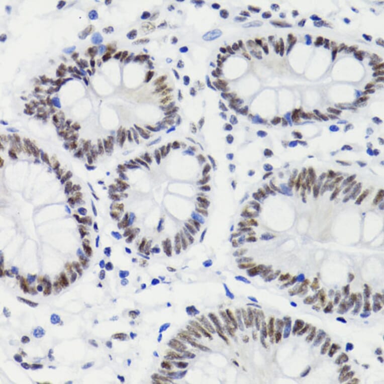 Immunohistochemistry - Anti-Bcl-2 (phospho Thr56) Antibody (A10923) - Antibodies.com