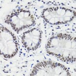 Immunohistochemistry - Anti-Bcl-2 (phospho Thr56) Antibody (A10923) - Antibodies.com