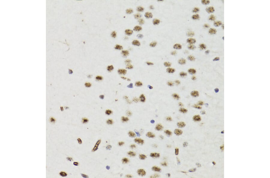Immunohistochemistry - Anti-Bcl-2 (phospho Thr56) Antibody (A10923) - Antibodies.com