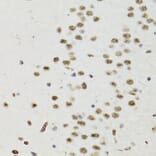 Immunohistochemistry - Anti-Bcl-2 (phospho Thr56) Antibody (A10923) - Antibodies.com