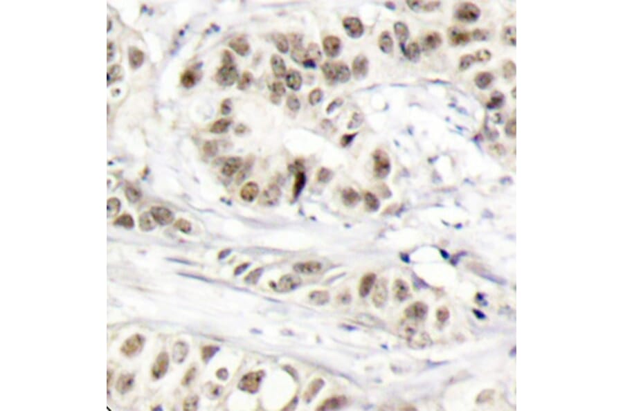 Immunohistochemistry - Anti-BRCA1 (phospho S1524) Antibody (AP0317) - Antibodies.com