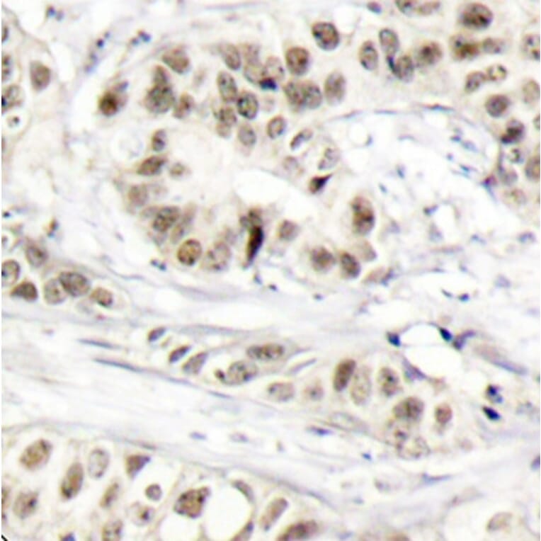 Immunohistochemistry - Anti-BRCA1 (phospho S1524) Antibody (AP0317) - Antibodies.com