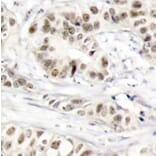 Immunohistochemistry - Anti-BRCA1 (phospho S1524) Antibody (AP0317) - Antibodies.com