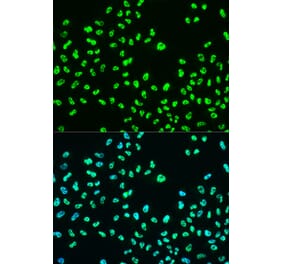Immunofluorescence - Anti-BRCA1 (phospho Ser988) Antibody (A10925) - Antibodies.com