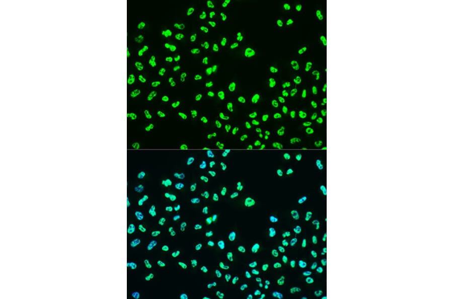 Immunofluorescence - Anti-BRCA1 (phospho Ser988) Antibody (A10925) - Antibodies.com