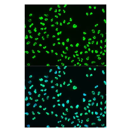 Immunofluorescence - Anti-BRCA1 (phospho Ser988) Antibody (A10925) - Antibodies.com